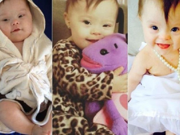 Jovem casal tem filha com Síndrome de Down e dão verdadeira lição de vidaCESD - Centro Síndrome de Down